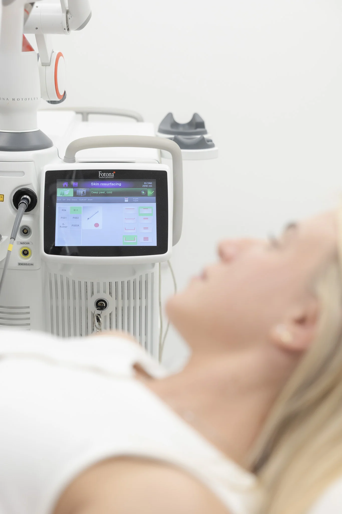 Fotona 4D Facelift treatment at Feonix Aesthetics clinic in Coventry