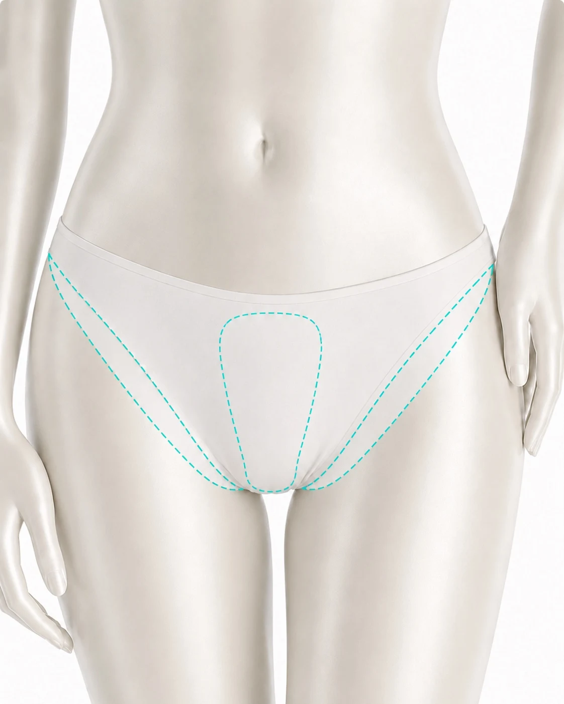 Diagram showing the bikini line treatment zone marked on the body: the strip running along both sides of the underwear edge at the top of the thigh, and the pubic area within it.