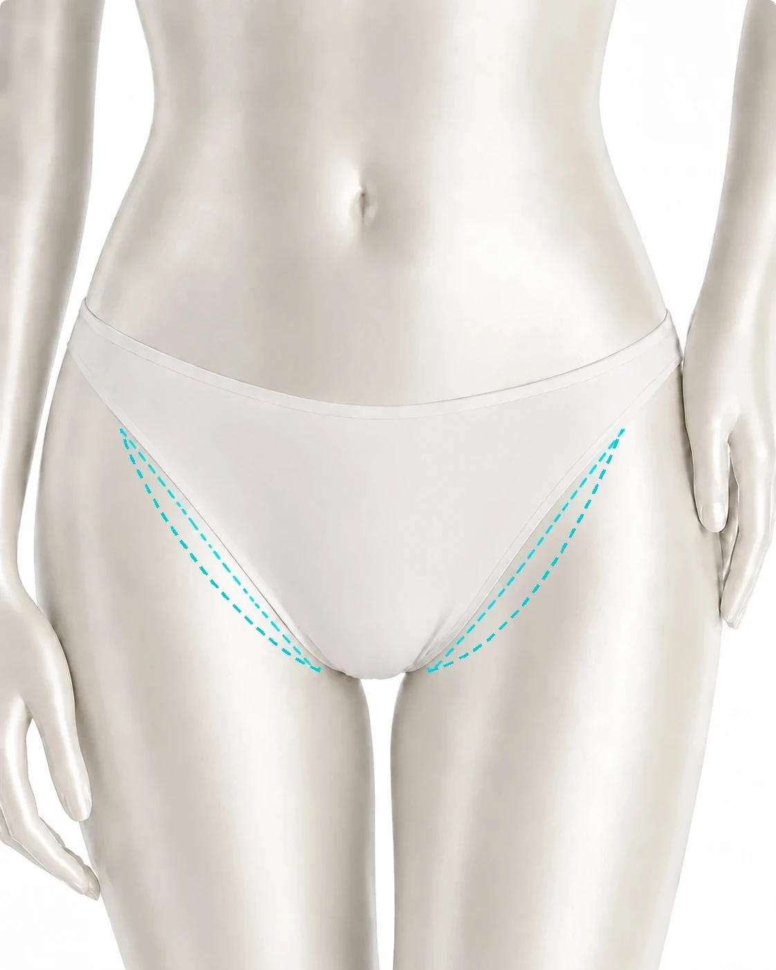 Diagram showing the inner thigh treatment zones marked on the body: a strip on the inside of each thigh, running from the groin crease down the inner leg, just outside the line of standard briefs.