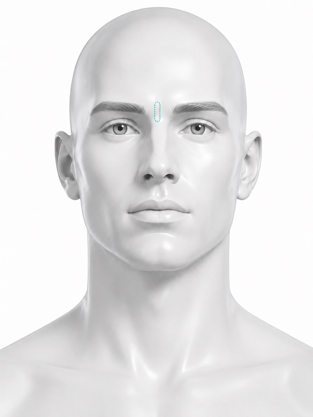 Front-view diagram of a man's face with a narrow vertical treatment zone marked between the eyebrows. The eyebrows themselves are not marked.