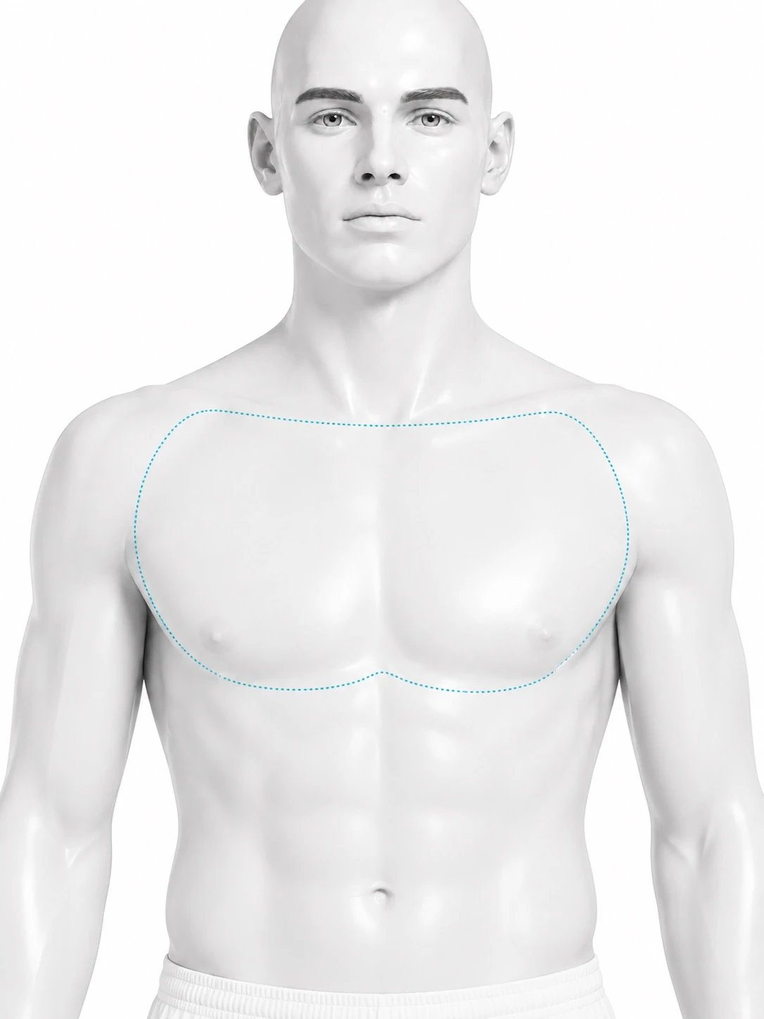 Front-view diagram of a man's torso with the chest treatment zone marked: from the collarbone down to below the pectorals, and out to the shoulder line on both sides. The stomach is not marked.