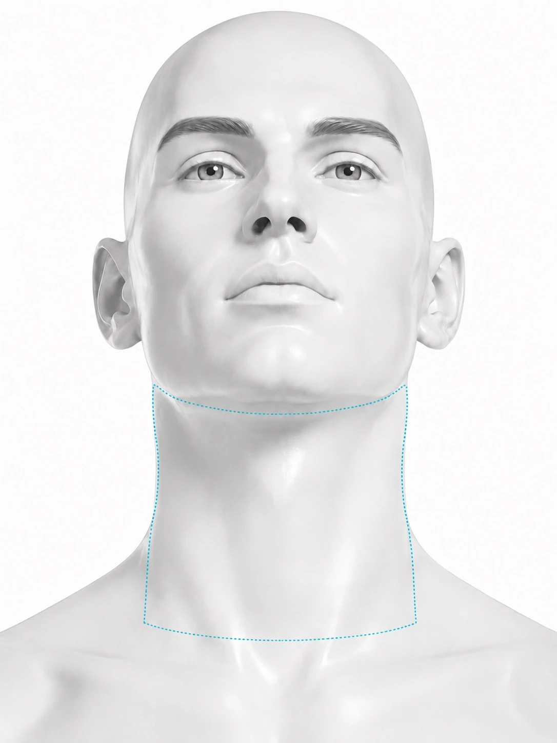 Front-view diagram of a man with the head tilted back and the treatment zone marked on the front of the neck: from under the jawline down to the collarbone, and out to the side of the neck on both sides.