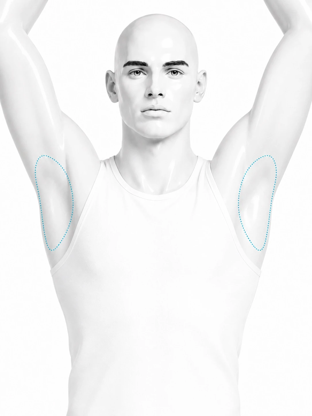Front-view diagram of a man with both arms raised and the treatment zone marked on each underarm: the hair-bearing area of the armpit.