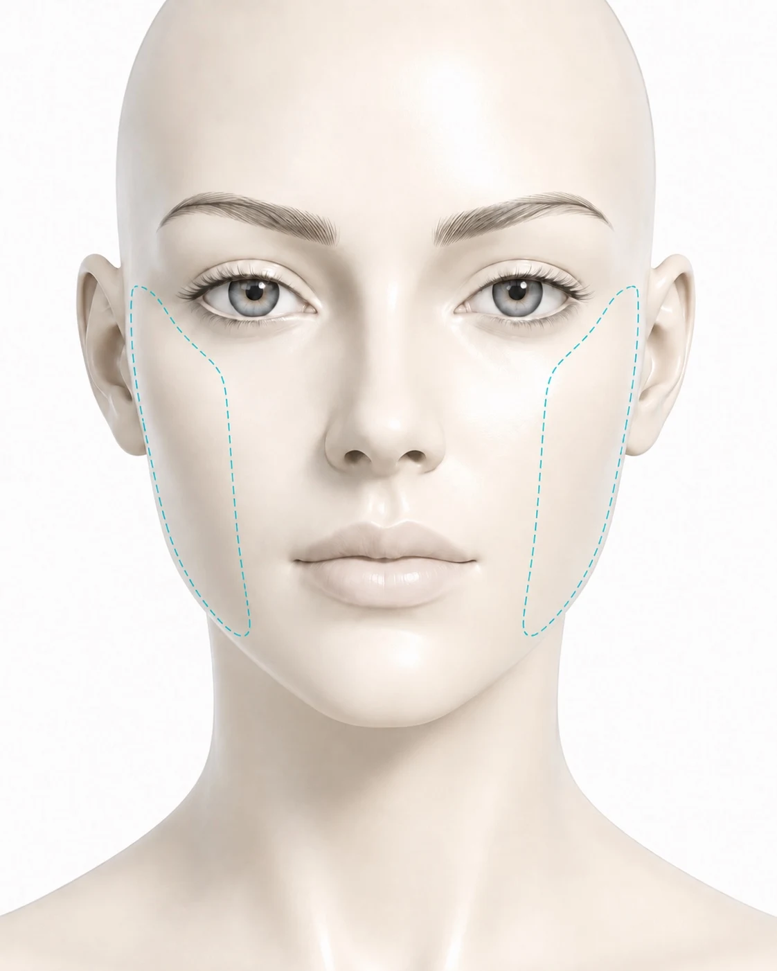 Diagram showing the sides of face treatment zones marked on both cheeks: the area in front of each ear running from the temple down past the cheek to the jawline.